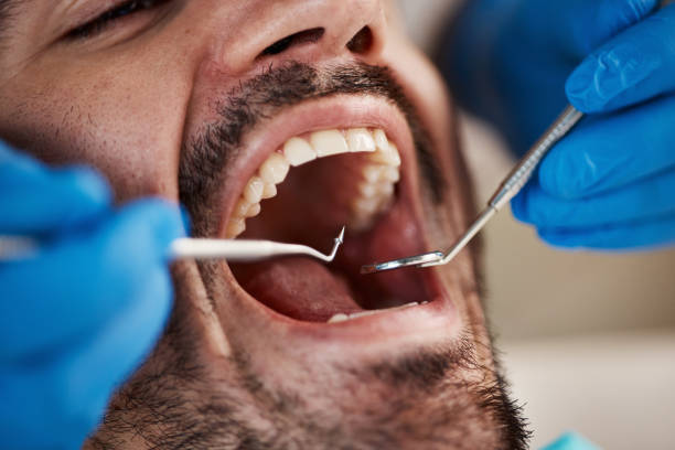 Best Emergency Dental Care for Broken or Chipped Teeth in Oak Park Heights, MN