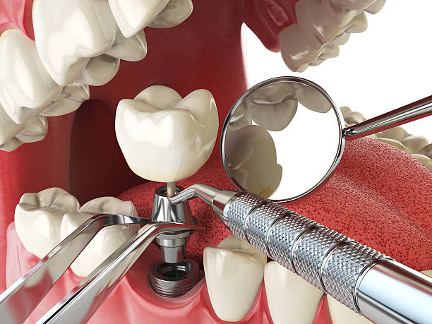 Best Emergency Dental Care for Broken or Chipped Teeth in Oak Park Heights, MN